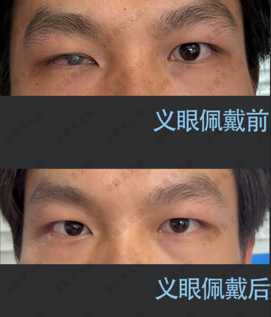 471573e9-95b9-4fe8-8738-b71a7b033833.png